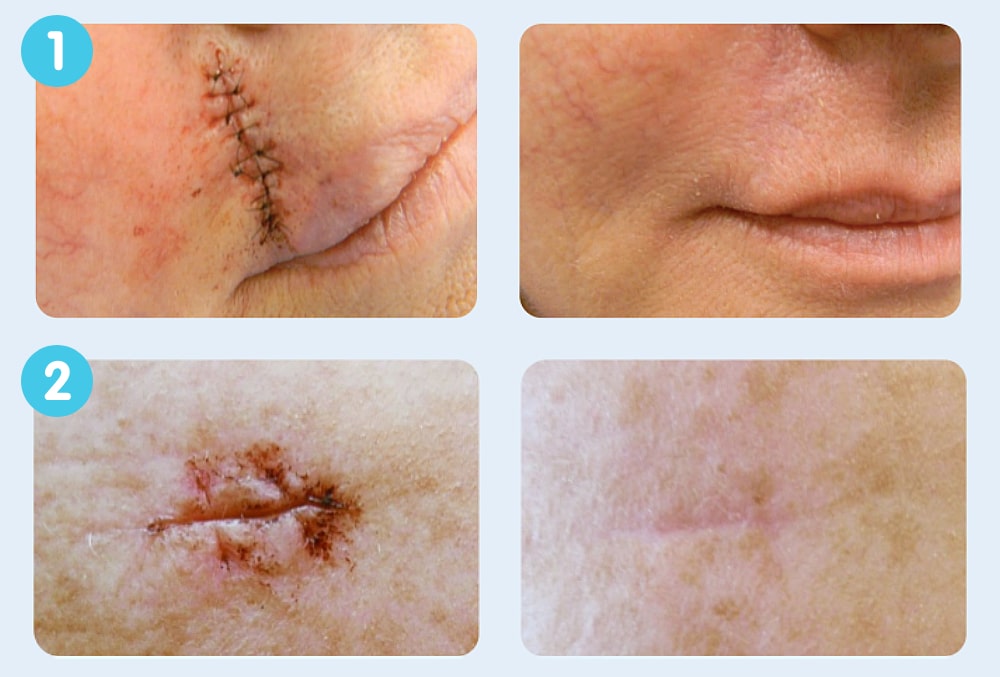 resultados stratamed