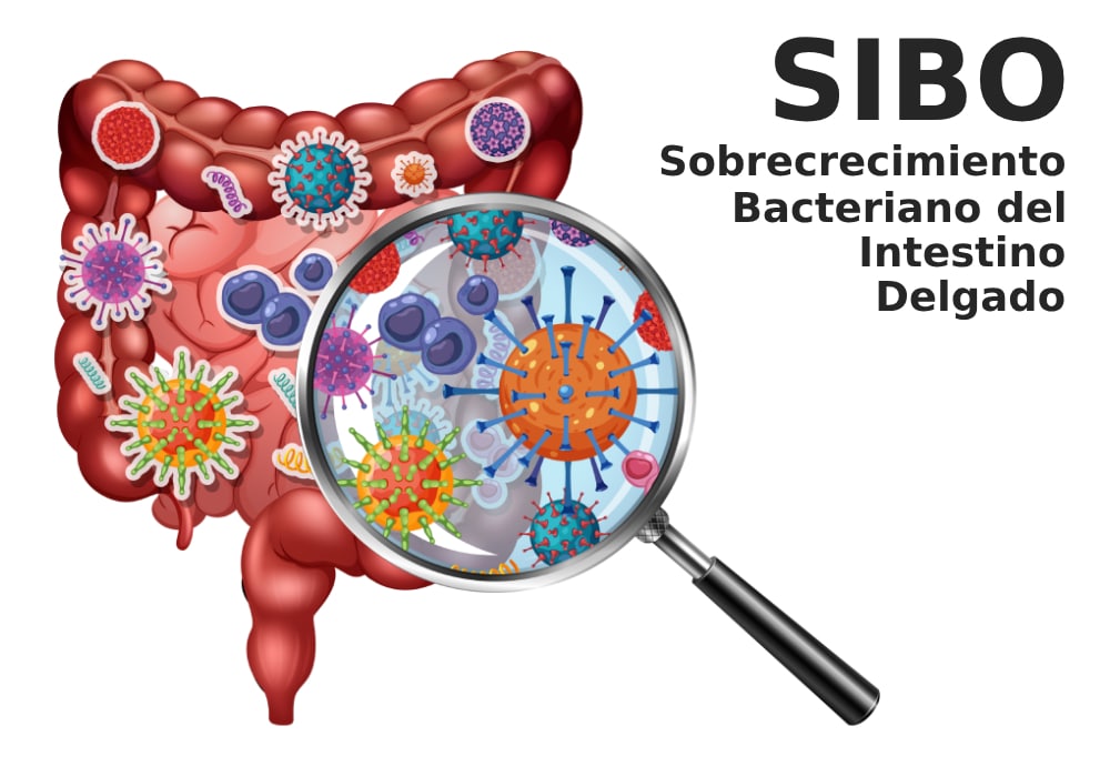 SIBO significado