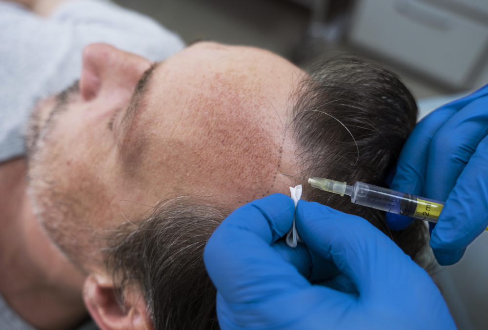 tratamientos farmacia para la caída cabello