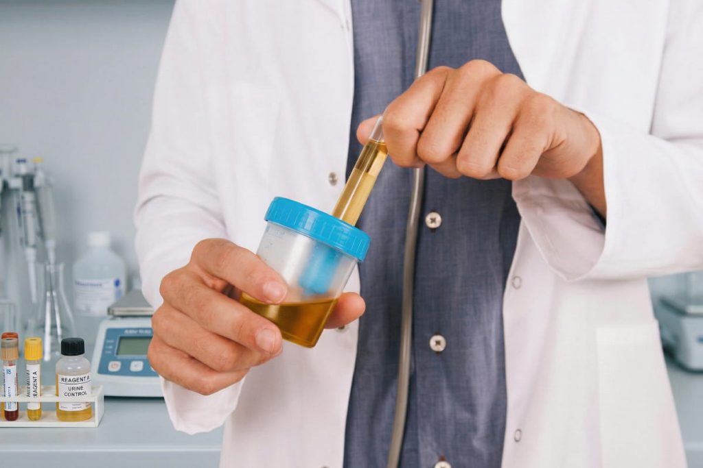 Profesional sanitario manipulando una muestra de orina en recipiente estéril para análisis